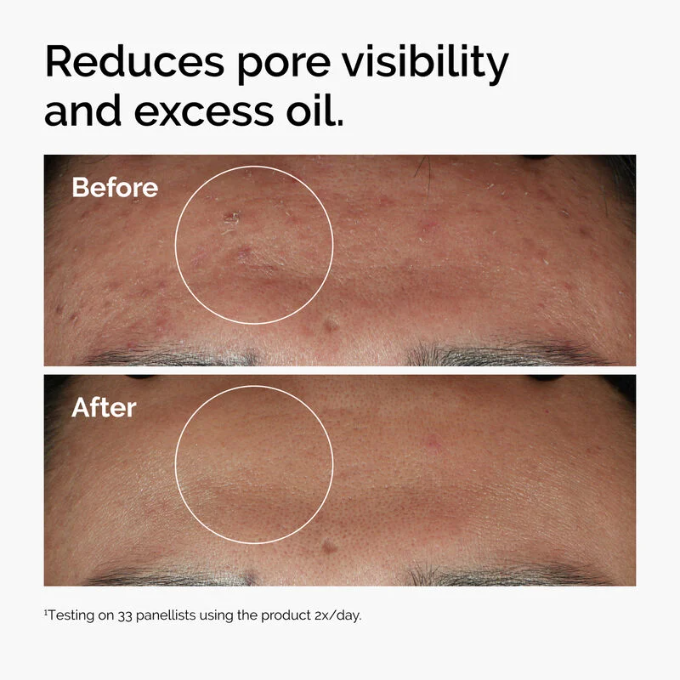 The Ordinary The Ordinary Niacinamide 10% + Zinc 1%, Smoothing Serum